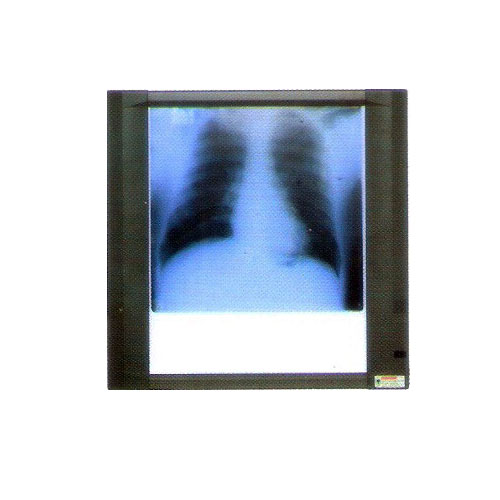 X Ray View Single Screen 84 - 0101