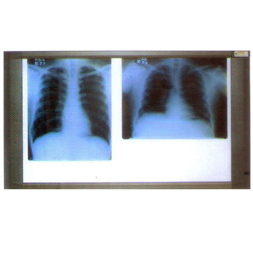 X Ray View Two Screen 84 - 0102