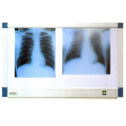 X Ray View Two Screen 84 - 0102F