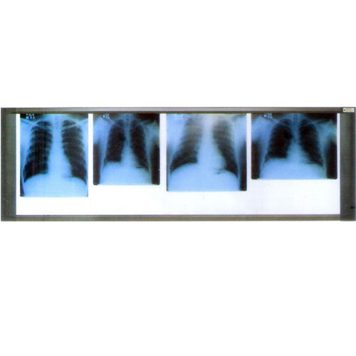X Ray View Four Screen 84 - 0102