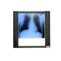 X Ray View Screens